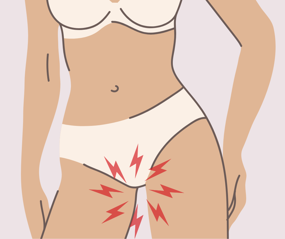 En finir avec les cystites après les rapports